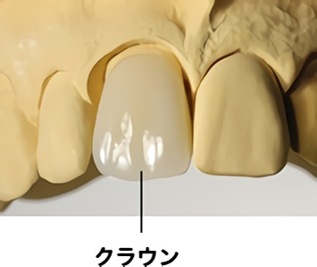 クラウン